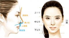 就想问问：隆鼻子一般多少钱？