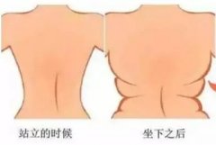 冰淇淋线你听过吗