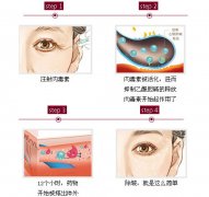 应用范围：