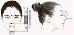 膨体隆鼻怎么样？