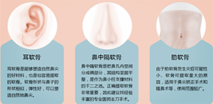 自体软骨隆鼻