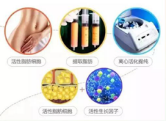 淄博自体脂肪丰胸哪家好？