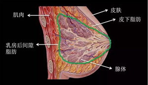 自体脂肪丰胸
