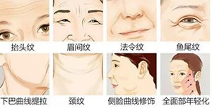 线雕面部