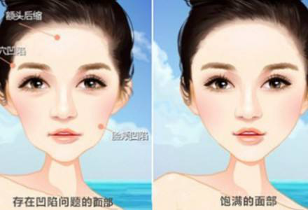 面部激活